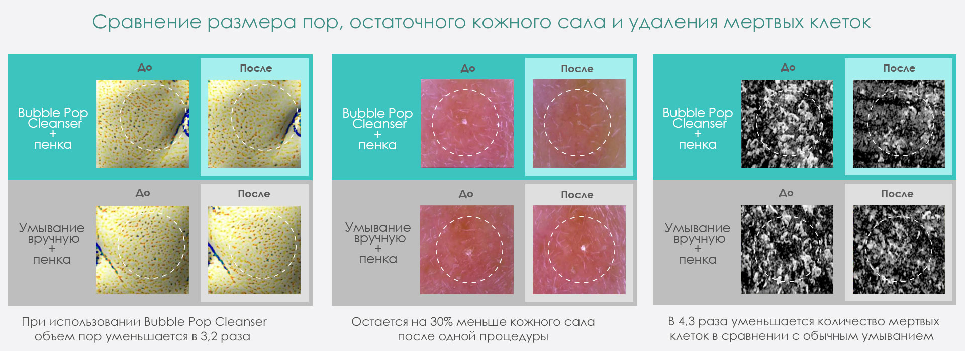 Размер пор при использовании VANAV Bubble Pop Cleanser заметно уменьшается