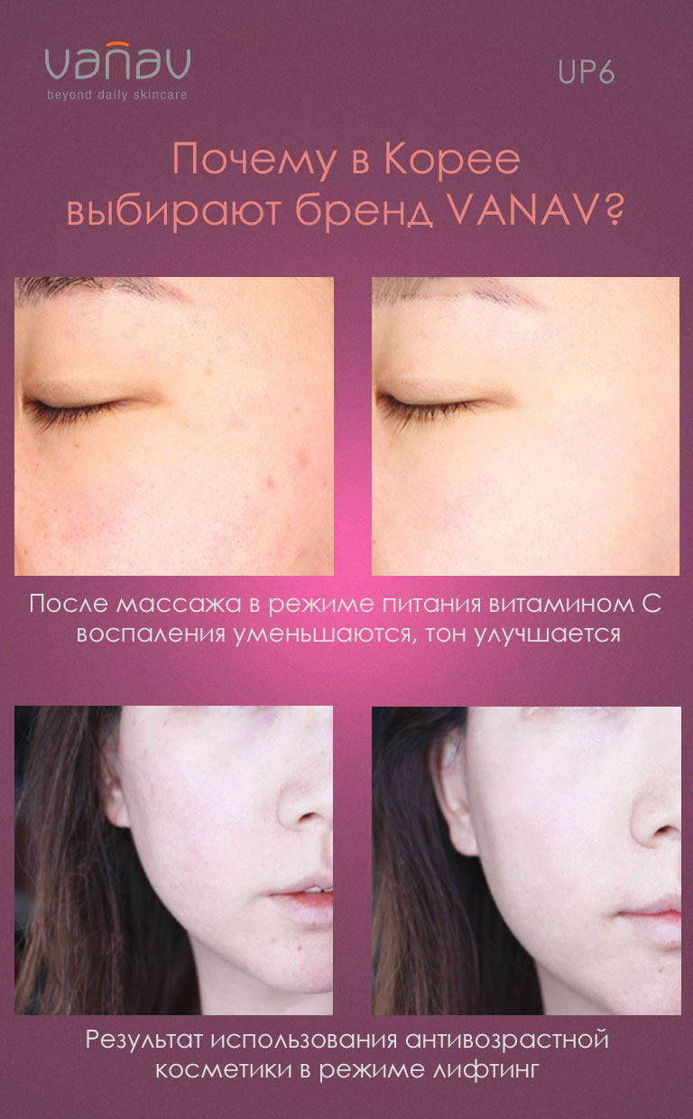 Результаты использования Массажера для лица VANAV UP6