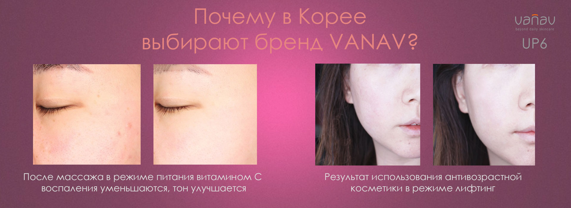 Результаты использования Массажера для лица VANAV UP6